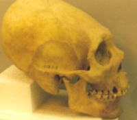 Elongated Skull