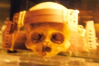 Skull Stretcher